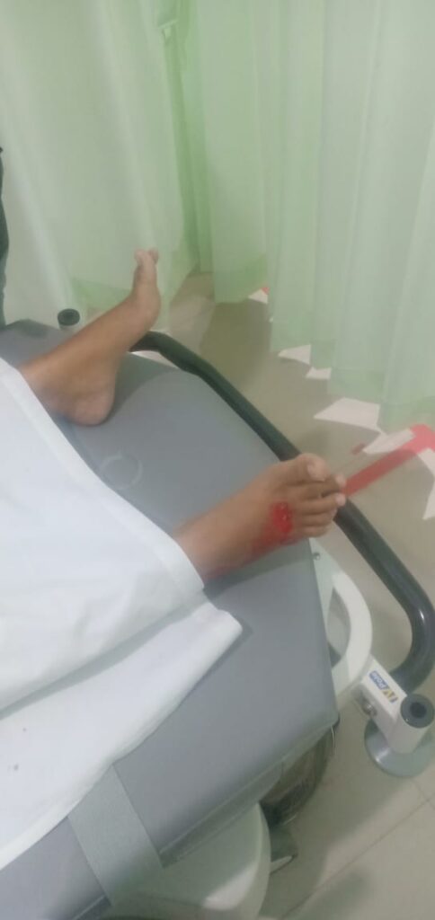 Tabrak Kucing, Mahasiswi STAKN Asal Palopo Meninggal Dunia