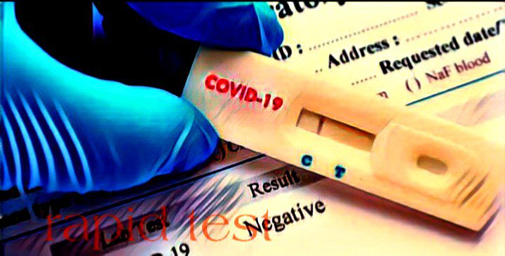 Jika Hasil Rapid Test Positif, Sebaiknya Jangan Panik, Ini Penjelasannya