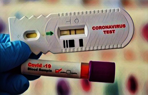 Pemkab Tana Toraja Terima Bantuan 5.000 Rapid Test Antigen dari BNPB