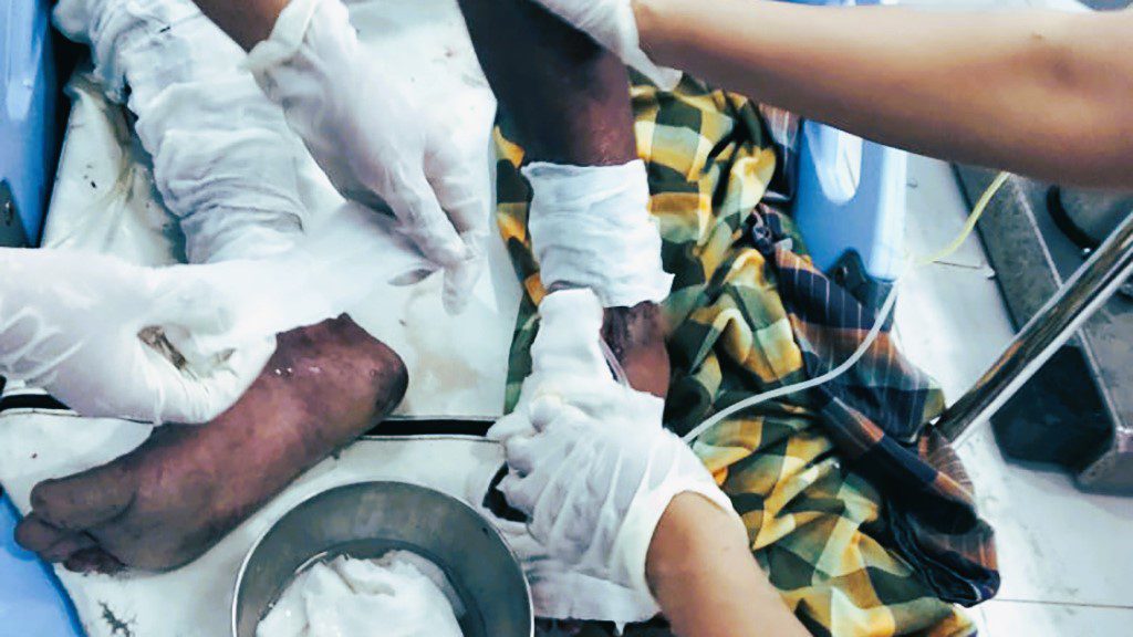 Kuli Bangunan Asal Makassar Tersengat Listrik di Lemo Tana Toraja, Tangan Putus