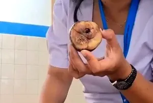 Siswa SD di Tana Toraja Terima Buah Tak Layak Konsumsi dalam Menu MBG