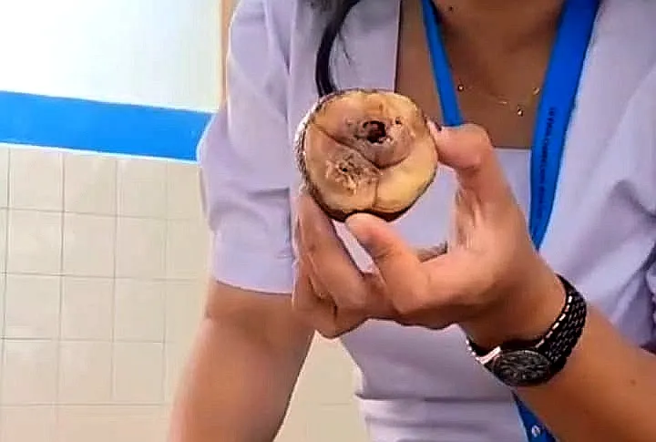 Siswa SD di Tana Toraja Terima Buah Tak Layak Konsumsi dalam Menu MBG 1 Siswa SD di Tana Toraja Terima Buah Tak Layak Konsumsi dalam Menu MBG